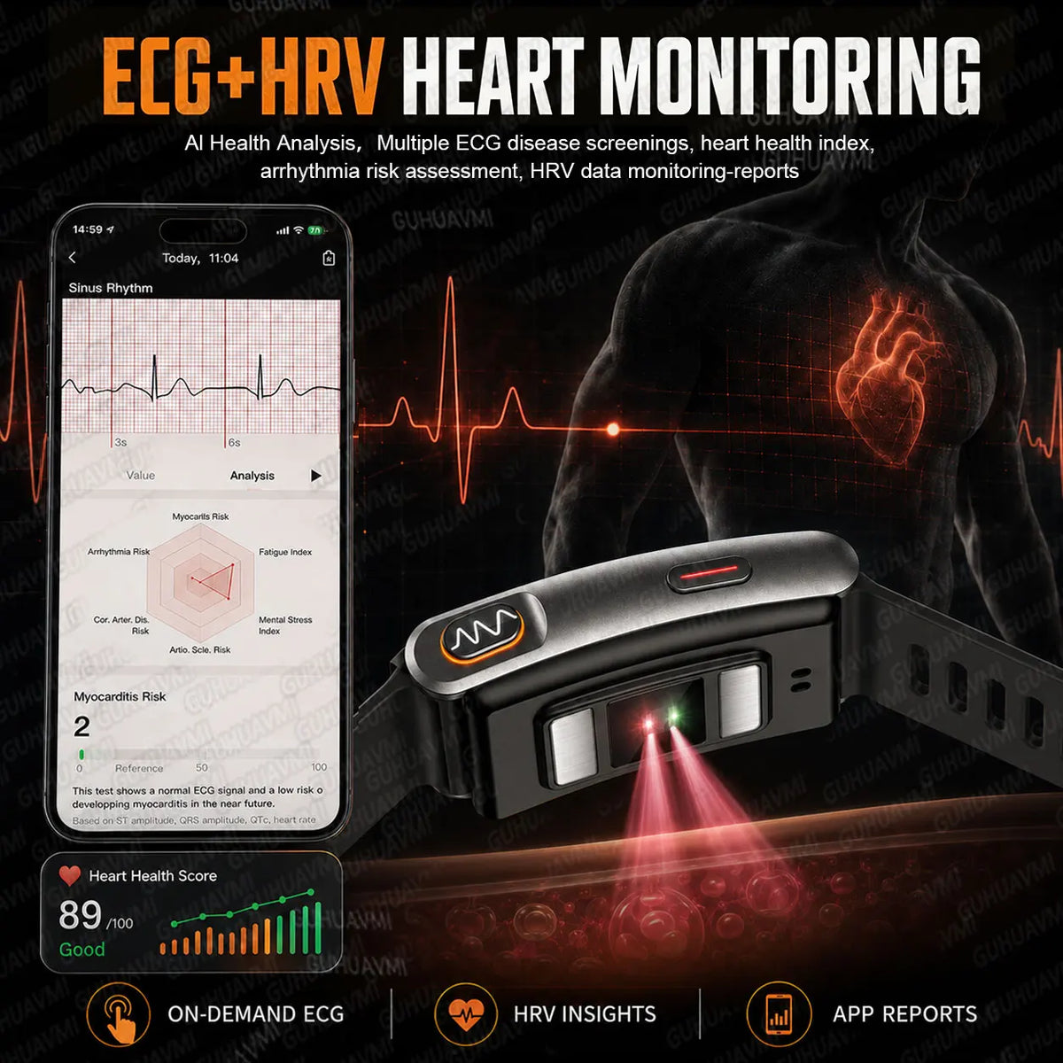 2026 Global Version Smart Wristband AI-Health Screenless Bracelet Blood Pressure ECG Uric Acid Waterproof Sports Fitness Tracker