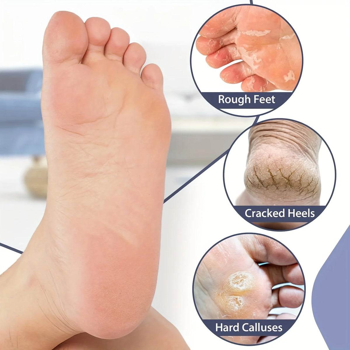Moisturizing Silicone Socks, Reusable Men's and Women's Pedicure Socks for Dry, Cracked and Rough Foot Skin, Highly Elastic, Non